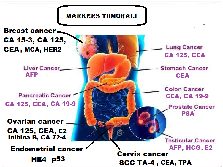 singer arithmetic Be confused Markers tumorali in oncologia ginecologica | FertilityCenter